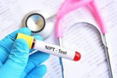 Comprehensive Nipt Testing At Concepto