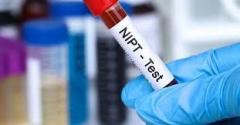 Affordable Nipt Lab Test Ireland  Concepto Nipt