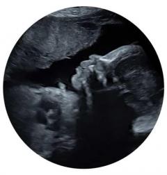 Looking For A Private Ultrasound Scan Clinic In 