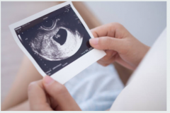 Ultrasound Baby Scan Services In Aylesbury At Wi