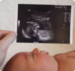 Experience The Best Ultrasound Baby Scan In Ayle