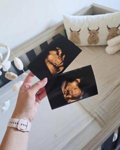 Discover Peace Of Mind With Private Ultrasound S