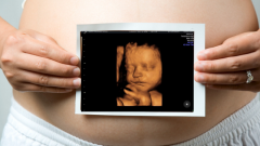 Plan Your Babys Future With Private Ultrasound S