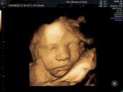 Experience The Wonder Of 4D Baby Scanning At Win