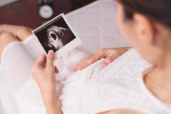 Avail A Fetal Well-Being Scan At Window To The W