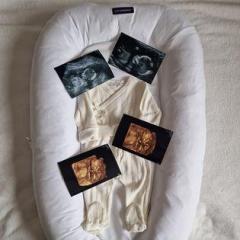Discover Your Babys Gender At The Best Scan Clin