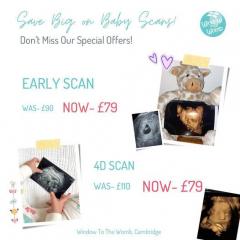 We Offer Private Ultrasound Scans For Your Baby 