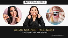 Clear Aligner Treatment  Competitive Pricing & E