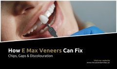 How E Max Veneers Can Fix Chips, Gaps & Discolou