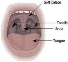 Natural Ways To Make Tonsil Stones Fall Out