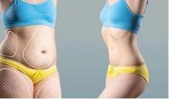 For Body Fat Reduction In London, Contact Us
