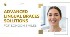 Advanced Lingual Braces Solutions For London Smi