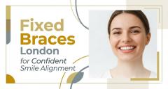Fixed Braces London For Confident Smile Alignmen