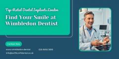 Top-Rated Dental Implants London Find Your Smile