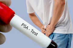 Same Day Private Psa Test In London
