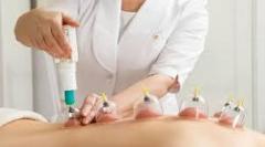 Learn Cupping Therapy Online: Master The Art Vir