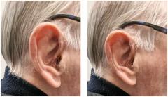 Affordable Private Hearing Aids In Leamington Sp