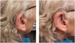 Private Hearing Aids In Stratford-Upon-Avon