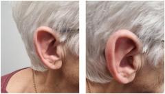 Professional Private Hearing Aids In Kenilworth