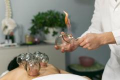 Relieve Pain Today With Cupping Therapy In Londo