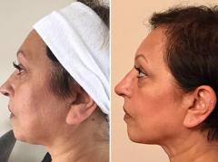 Private Dermatology Clinic In Maidenhead - Priva