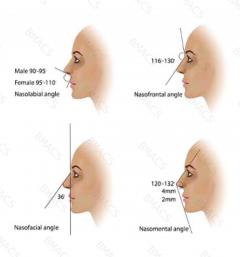 Non-Surgical Nose Reshaping In Chiswick  Quick &