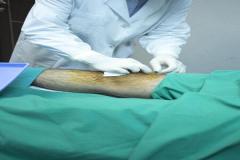 Knee Specialist Services Available In Hale