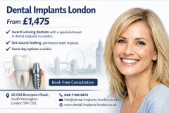 Natural-Looking Dental Implants In London