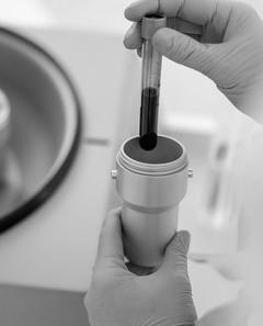 Prp Microneedling Treatments For Skin Glow  Dr. 
