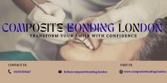 Composite Bonding London - Transform Your Smile 