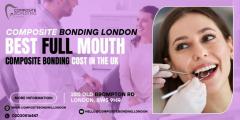 Composite Bonding London  Best Full Mouth Compos