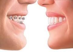 Affordable dental treatments in central London