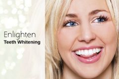 Teeth Whitening in North London for Brighter Smile