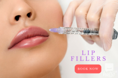 Affordable Lip Fillers In London At Clinica Fior