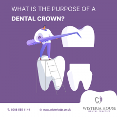 Dental Crowns Treatment In London