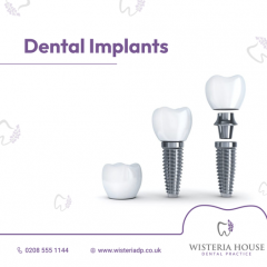 Best Dental Implants In London