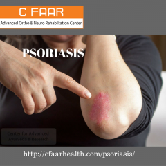 psoriasis ayurvea can cure