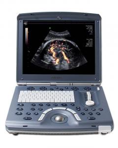 Ultrasound System Ge Voluson E