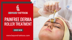 Beyond Tattoos  Painfree Derma Roller Treatment