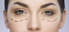 Are You In Search Of Blepharoplasty Eyelid Surge