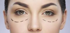 Looking For Effective Cosmetic Eyelid Surgery Di