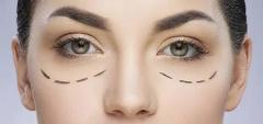 Choose Blepharoplasty & Gain More Refreshed And 