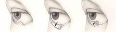 Restore Comfort And Eye Protection With Expert E